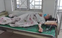 Bệnh nhân đái tháo đường gặp biến chứng do không tuân thủ điều trị