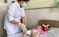 Cảnh báo tình trạng bỏng ở trẻ em