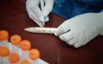 TP Hồ Chí Minh: Thanh tra việc mua sắm bộ sinh phẩm xét nghiệm nhanh COVID-19