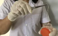 Yên Bái: Phát hiện 1 bệnh nhân nhiễm giun rồng