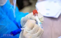 Phú Quốc đẩy mạnh xét nghiệm COVID-19