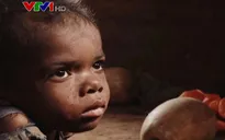 Đói nghèo cùng cực, nhiều người dân Madagascar phải ăn những miếng da giày