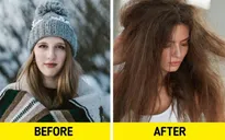 Mẹo hiệu quả khắc phục tóc khô, chẻ ngọn, gãy rụng vào mùa đông