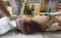 Khởi tố "mẹ kế" bạo hành khiến bé gái 8 tuổi tử vong