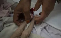 Hàng triệu trẻ em ở Afghanistan chống chọi với cái đói để tồn tại