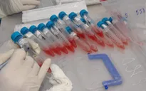 Gia Lai có ca dương tính với SARS-CoV-2 thứ 14