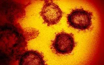 Toàn bộ virus SARS-CoV-2 trên thế giới chỉ đựng vừa trong một lon nước 330 ml