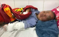 Thêm nhiều ca thương tích nặng do pháo nổ