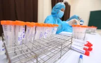 Hà Nội phát hiện 1 F1 của ca dương tính SARS-CoV-2 ở Hà Nam