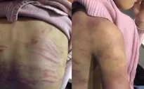 Phê chuẩn quyết định khởi tố mẹ và người tình bạo hành, cưỡng bức bé gái 12 tuổi