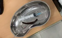 Gắp con vắt dài 20 cm khỏi... mũi người đàn ông