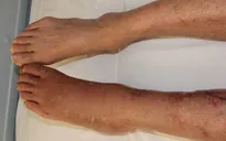 Những nguy cơ tiềm ẩn dễ nhầm lẫn của đau xương khớp