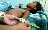 Liên Hợp Quốc quyết tâm giải quyết nạn đói do xung đột