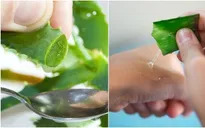10 mẹo giảm thâm nám da tự nhiên mà hiệu quả