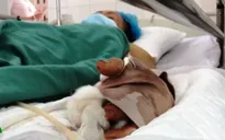 Trồng sả để phòng rắn, 2 người bị rắn cắn