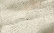 Cảnh báo dị vật tiêu hóa ở trẻ em