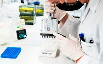 Lại phát hiện biến chủng SARS-CoV-2 mới tại CH Séc