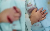 Bé gái 3 tuổi đứt gần lìa nhiều phần bàn tay phải do quạt hơi nước
