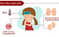 [INFOGRAPHIC] Tăng cường chống dịch tay chân miệng thời điểm giao mùa
