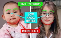 Tại sao người châu Á chậm lão hóa hơn?