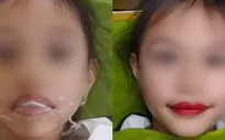 Xôn xao thẩm mỹ viện phun môi cho... bé gái 5 tuổi