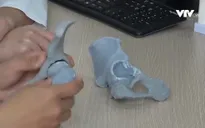 Ứng dụng công nghệ 3D trong chẩn đoán bệnh xương khớp