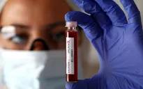 Anh thử nghiệm tái nhiễm SARS-COV-2