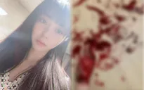 Kwon Mina (AOA) đăng hình tự tử gây choáng