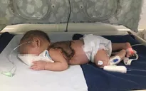 Dùng kim khâu chích mụn, bé sơ sinh nhiễm trùng huyết nguy hiểm