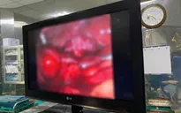 Sốt, đau bụng, vào viện phát hiện áp xe buồng trứng