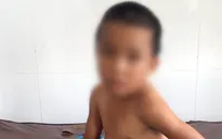 Điều tra vụ cha dượng bạo hành con riêng của vợ