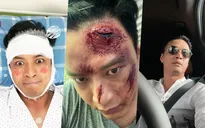 Hướng dương ngược nắng: Kiên (Hồng Đăng) đúng chuẩn chàng trai vàng trong làng ăn tát và nằm viện
