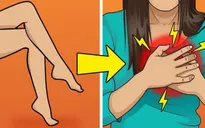 Thói quen ngồi vắt chéo chân có thể gây tê liệt thần kinh
