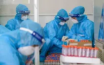 Trưa 11/6: Thêm 82 ca mắc COVID-19 mới, hơn 188.000 người đang được theo dõi, cách ly
