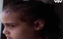 Tổn thương tâm lý nghiêm trọng ở trẻ em sau đụng độ Palestine - Israel