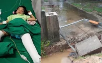 Bé gái 8 tuổi bị cổng nhà văn hóa đổ đè gãy hai chân