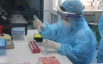 Toàn bộ 8 mẫu dương tính sau test nhanh ở Nghệ An cho kết quả âm tính với SARS-CoV-2