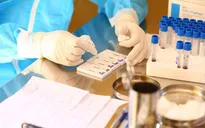 Sáng 17/7, có 2.106 ca mắc COVID-19, TP Hồ Chí Minh nhiều nhất với 1.769 ca