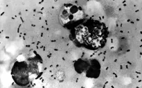 Phát triển loại vaccine dịch hạch mới sẵn sàng thử nghiệm trên người