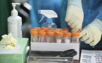 Xét nghiệm tìm kháng thể cho người đã tiêm vaccine COVID-19 ở TP Hồ Chí Minh