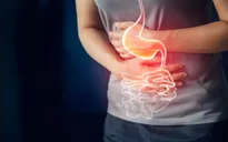 5 thực phẩm tuyệt vời nhất cho người mắc chứng khó tiêu