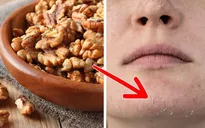 5 công dụng làm đẹp da bất ngờ của quả óc chó