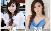 Midu tung bằng chứng phủ nhận phẫu thuật thẩm mỹ