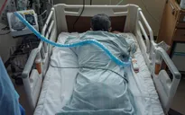 Nghiên cứu mới: Di chứng COVID-19 có thể kéo dài một năm