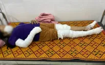 Nghệ An: Dựng cây nêu đón Tết, 3 người bị điện giật nhập viện
