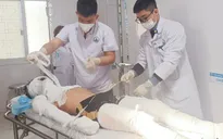 Nam sinh lớp 11 bỏng toàn thân do đốt pháo hoa