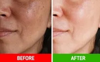 Sẵn sàng đón Tết với 8 mẹo "chữa cháy" cực đỉnh cho làn da