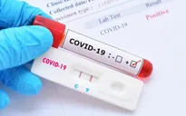 Thanh tra việc mua sắm kit test COVID-19 tại Bộ Y tế, Hà Nội, TP Hồ Chí Minh
