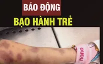 Vụ bé gái 8 tuổi bị bạo hành: Xin đừng lặng im!