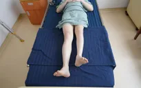 Kỳ tích kéo dài chân 13cm cho bệnh nhân ung thư xương